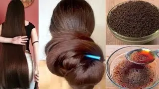 💯DIY Onion Oil for Extreme Hairgrowth/कसम से बस 1 बार लगा कर देखो बाल 20 गुना तेजी से बढ़ेंगे 😱 #yt 