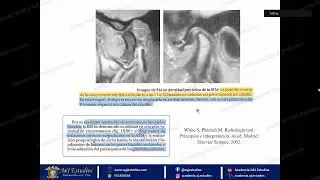 Transmisi&oacute;n en vivo de Noe Garcia Ataucusi