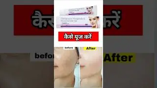 clinsol gel cream uses in hindi #ajaypharma #skincare #shortsvideo #shortsfeed #clinsolgel