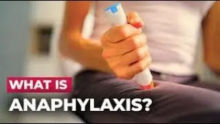 Understanding Anaphylaxis: Life-Saving Info You Need to Know #shorts #youtubeshorts