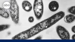 2 dead and 58 sick from growing Legionnaires' disease cluster in New York City