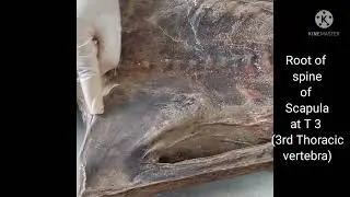 Surface anatomy of Back (on mummified body)