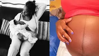 PREGNANCY ||THE GOOD, THE BAD AND THE UGLY||WEIRD AND EMBARRASSING PREGNANCY SYMPTOMS 😳 AND MORE
