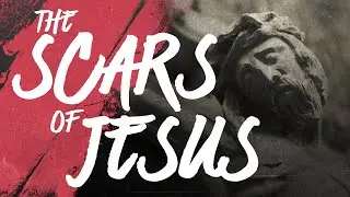 Did All of Jesus's Crucifixion Scars Transfer to His Post-Resurrection Body?