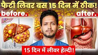 Liver Detox Drink at home | Liver Kharab Hone Ke Lakshan | Liver Detox Kaise Kare