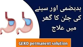 Gastroesophageal reflux disease treatment at home || seeny ki jalan || GERD permanent solution