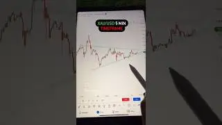 Forex trading strategy | Pips | Trading wizard #forextrading #ytshortvideo