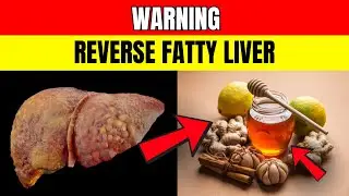 The Liver Detox Diet for Seniors: Reverse Fatty Liver Naturally