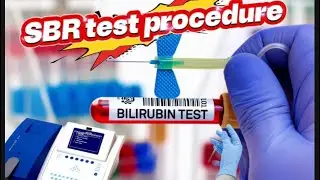 Serum bilirubin test procedure,sbr test, microlab 300,biochemistry 