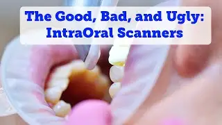 Advancements in Digital Dentistry  - Intra Oral Scanners - Client Reviews & Tips