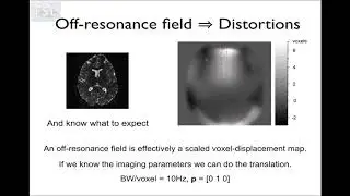 39. Diffusion 2: Distortion and Movement Correction (Diff E4)
