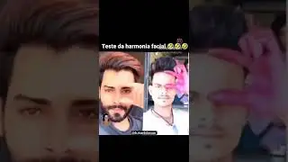The Importance Of Facial Ratios To Attractiveness (blackpill)