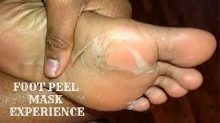 MY SOFTTOUCH FOOT PEEL MASK REVIEW! | EDEN