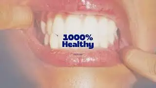★𝟏𝟎𝟎𝟎% 𝑯𝑬𝑨𝑳𝑻𝑯𝒀★| Subliminal Version 2