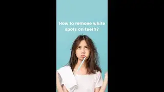 How to remove white spots on teeth?
