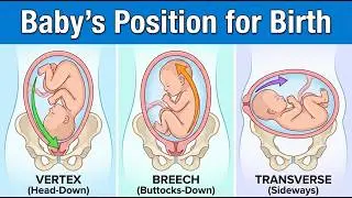 36 Weeks & Breech? | Is Baby Head Down? | Fetal Position Guide | Pregnancy Tips