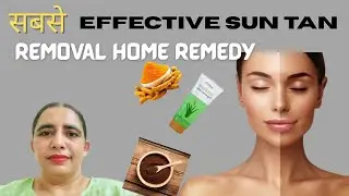 Sun Tan Removal Naturally Fast Remedy At Home | Best D- Tan At Home