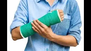 Cleaning an arm after a cast is removed