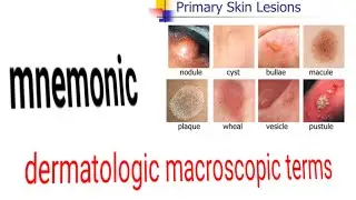skin lesions mnemonic