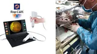 SUOER SW-8000/8000P Geniş Alan ROP Kamera