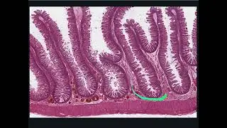 Digestive System Histology - Distal Duodenum; Plicae Circulares, Submucosa, Muscularis Externa