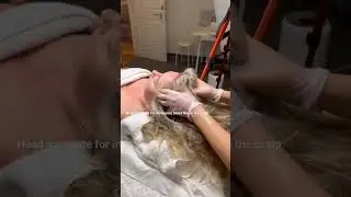 Head massage for increasing blood flow in the scalp #hair #hairloss #hairgrowth #hairtreatment