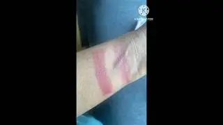 Best Lipbalm For Pigmented Lips| labello Blackberry Shine | #shortsvideo #youtubeshorts