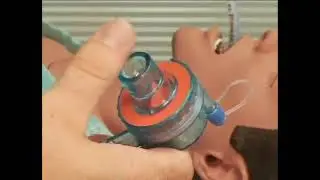 Pneupac® ventiPAC™ Ventilator