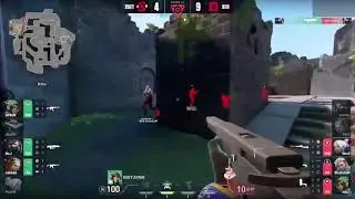 whats up with the sentinel 4k (SENTINELS vs XSET)