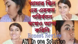 স্বপ্নেও আশা করিনি আমার এরকম পরির্বতন।Nature Sure facial beauty oil HONEST REVIEW@Arpitaandmithi