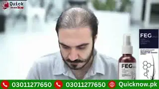 FEG Plus Hair Growth Spray Review | Does It Really Work for Thicker, Fuller Hair?