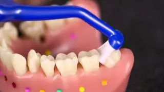 TePe Cleaning Around Missing Teeth