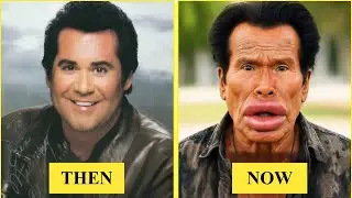 10 Most UNBELIEVABLE Plastic Surgery of Male Hollywood Celebrities | Then and Now 2025