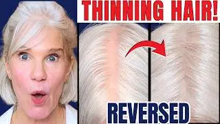 Thinning Hair Over 50? I Tried This Stem Cell Derived Serum for 18 Months (Honest Results & Demo)