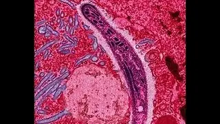 Ready, Set, Attack   How Your Body Fights Infection -   Lora Grainger