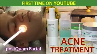 ACNE TREATMENT WITH ULTRASONIC AND HIGH FREQUENCY I postQuam Professional