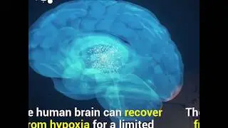 What happens to the brain without oxygen?