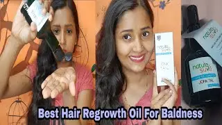 Jonk Tail Ke Fayde | Jonk Tail Leech Oil For Alopecia And Baldness