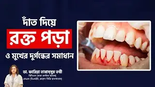 দাঁত দিয়ে রক্ত পড়া ও মুখের গন্ধ দূর করার উপায় | Gum Bleeding Treatment at Home | Bad Smell of Mouth