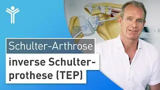 Schulterarthrose & Sehnenriss &ndash; Schulterschmerzen durch inverse Schulterprothese (TEP) behandeln
