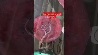 Obg 🩺📚Abnormal Placenta Project #YouTubeshrots #bscnursing #trending #model #3d