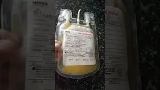 FFP( Fresh frozen plasma )