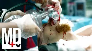 Wild Mushrooms Almost Make an Orphan | Transplant | MD TV