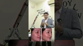 Q-Switched Nd:YAG Laser Treatment for Acne, Open Pores & Oil Control | Parashar Skin Clinic Delhi
