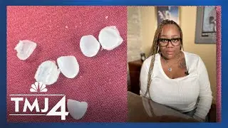 Woman sues unlicensed ‘fake dentist’ in Milwaukee after veneers ruin her teeth