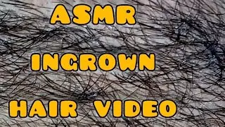 Calming Skin & Hair ASMR &ndash; Instant Relaxation#hair #asmr #hairmassage 