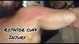 Rotator Cuff Rehab!