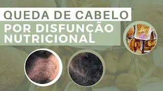 SAIBA COMO REVERTER ESSE QUADRO! | Dr. João Gabriel Fernandes