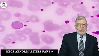 Episode 11 : RBCs Abnormalities Part 9
