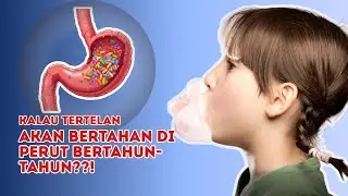 [HOAX] Permen Karet Bertahan Di Perut Selama Bertahun-tahun